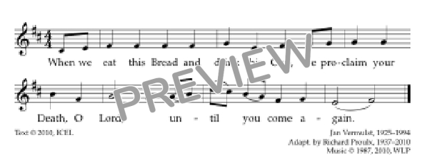 Score placeholder